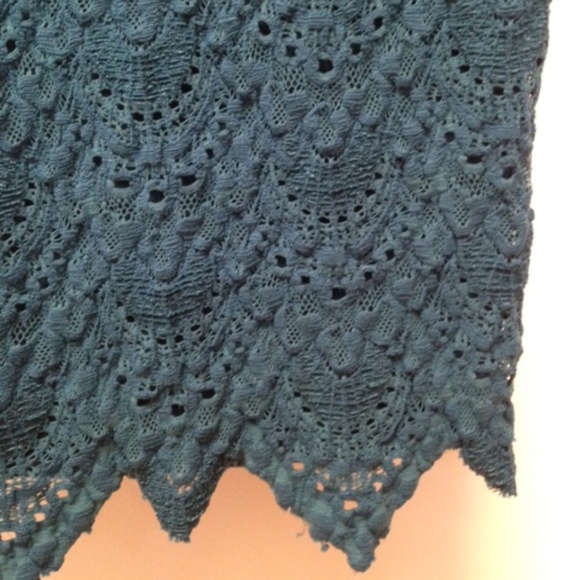 NIGHTCAP Lace Priscilla Open Back Dress EUC - Picture 9 of 12